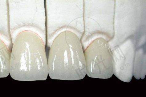 上班族选择东莞健力口腔医院收费标准诚不欺人的3个提醒