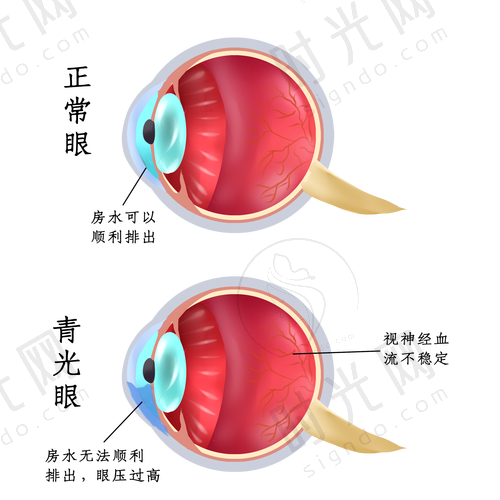 北京同仁医院眼科预约挂号攻略术前术后避坑指南