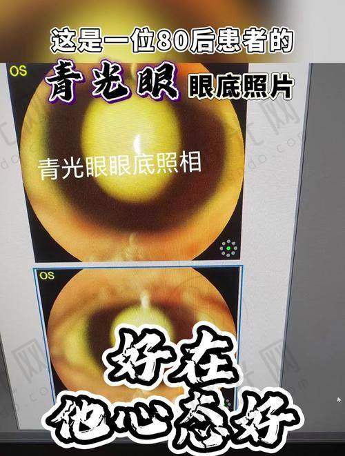 河北邢台眼科医院骨干医生挂号真相揭秘